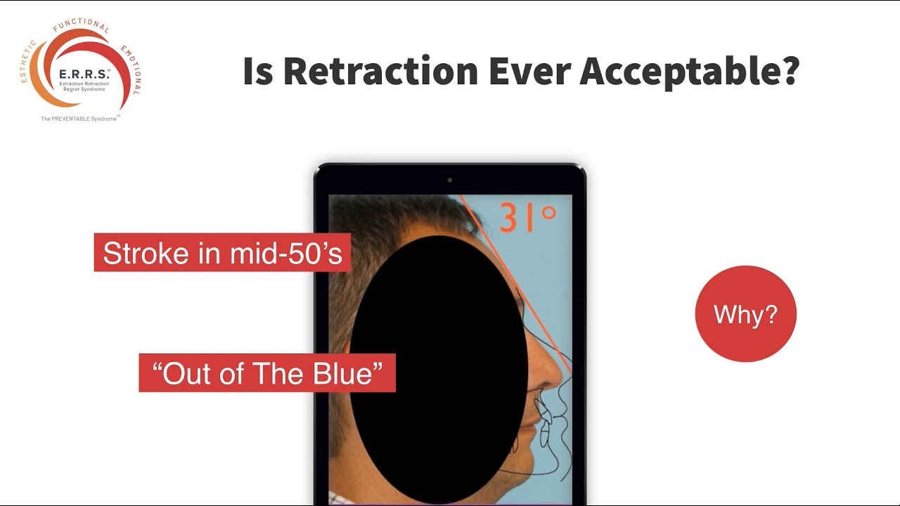 Is Retraction Ever Acceptable?