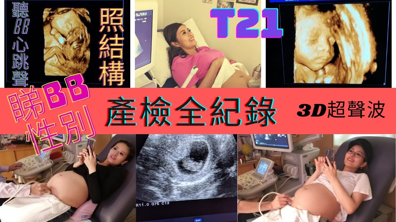 懷著馮寶寶的產檢全紀錄  | 3D Ultra Sound | 3D超聲波  | T21 | 照結構 | 聽bb心跳聲 | 照BB性別