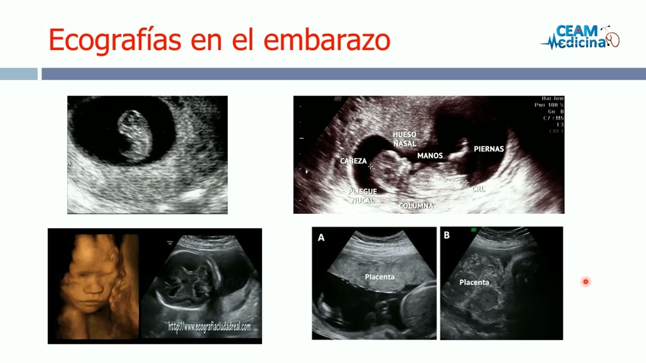 OBSTETRICIA CONTROL PRENATAL