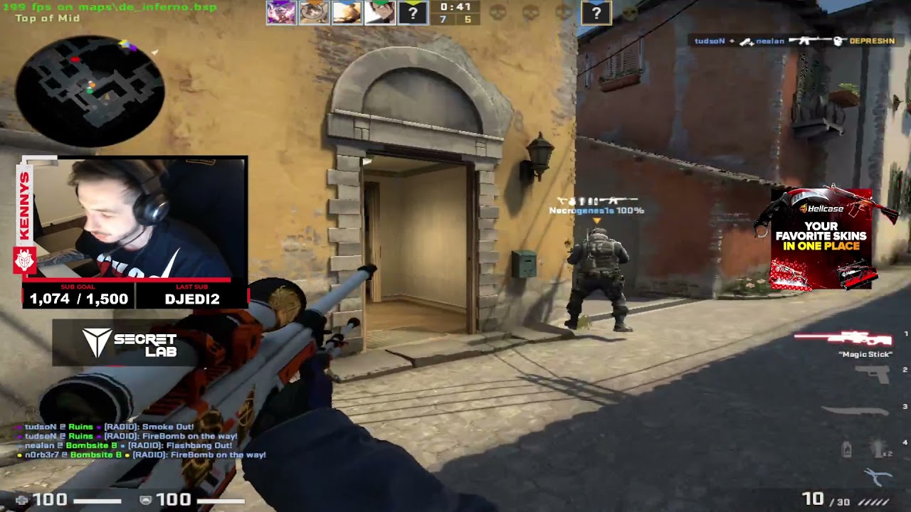 kennyS wrist broken flick