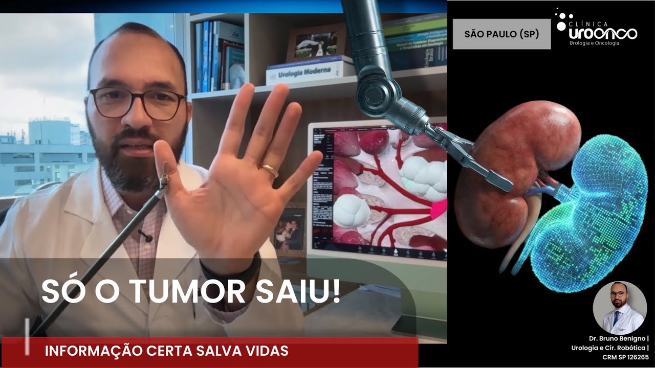 5 Coisas que Você PRECISA SABER ANTES de Operar um NÓDULO no RIM (O Guia da Robótica).