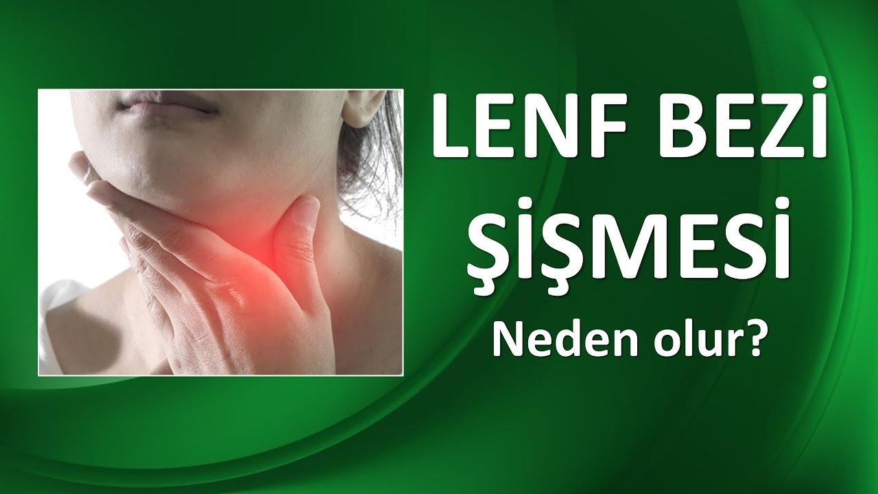 LENF BEZİ ŞİŞMESİ
