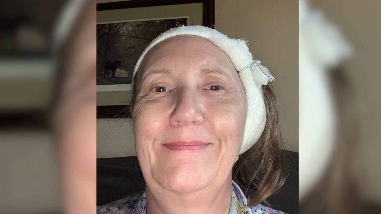 CW50 Woman Regains Hearing in Ear After Suffering From One-Sided Deafness for 50 Years