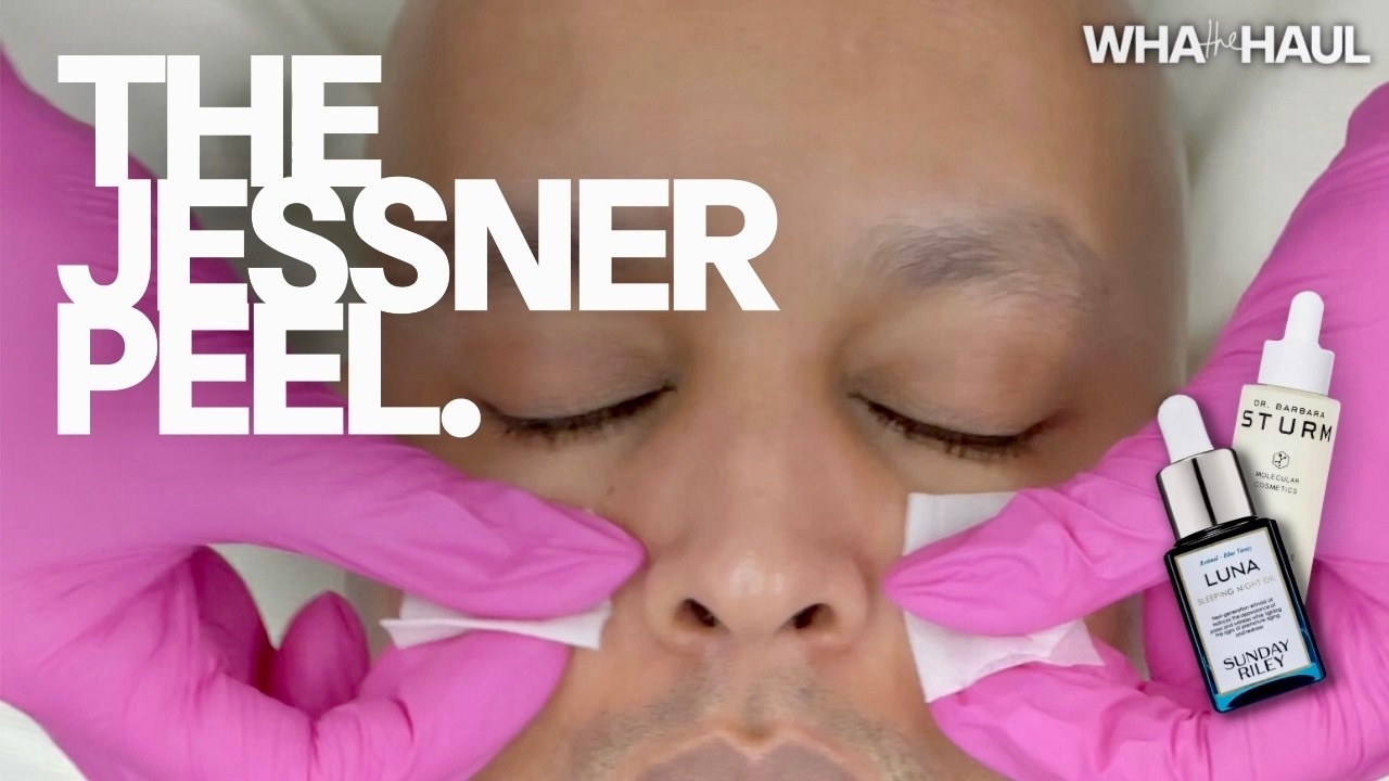 THE JESSNER PEEL | Is It Worth It? Detailed Before & After