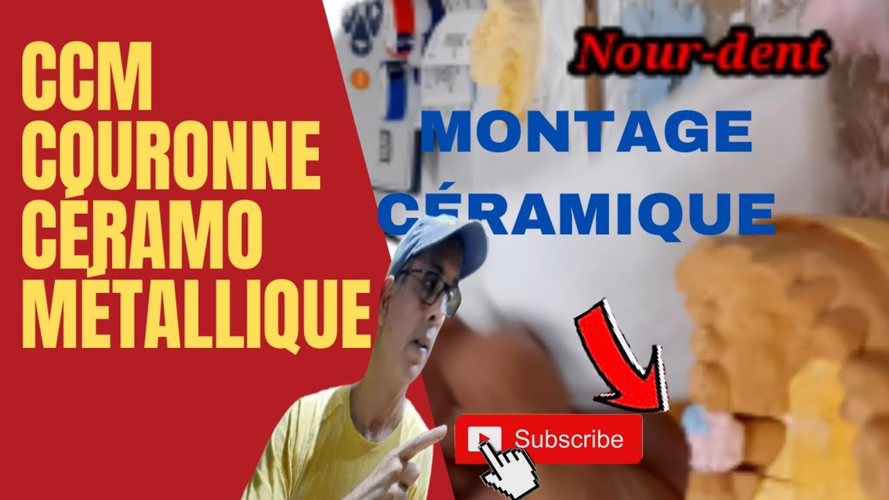 CCM. couronne céramo métallique. montage céramique. @NoureddineVlogsBr