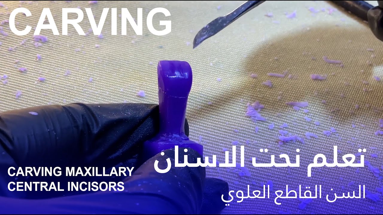 طريقة نحت السن القاطع العلوي - Carving Maxillary Central Incisor