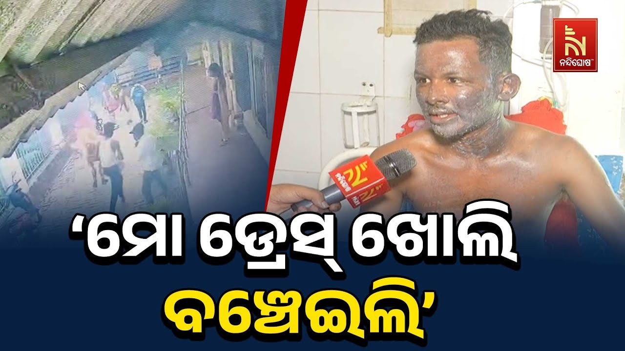 ‘ନିଜ କଥା ନ ଭାବି ସାର୍ଟ ଖୋଲି ତାଙ୍କ ଜୀବନ ବଞ୍ଚାଇବାକୁ ଦୌଡ଼ିଗଲି...’ | Balasore Girl Fire Accident