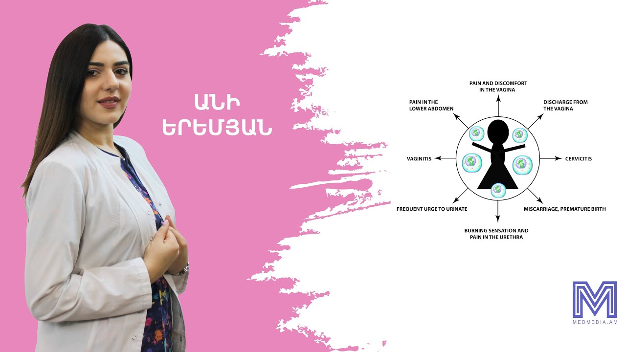 Ուրեապլազմոզ. ախտանշանները և բուժումը․ «Կնոջ Առողջություն»