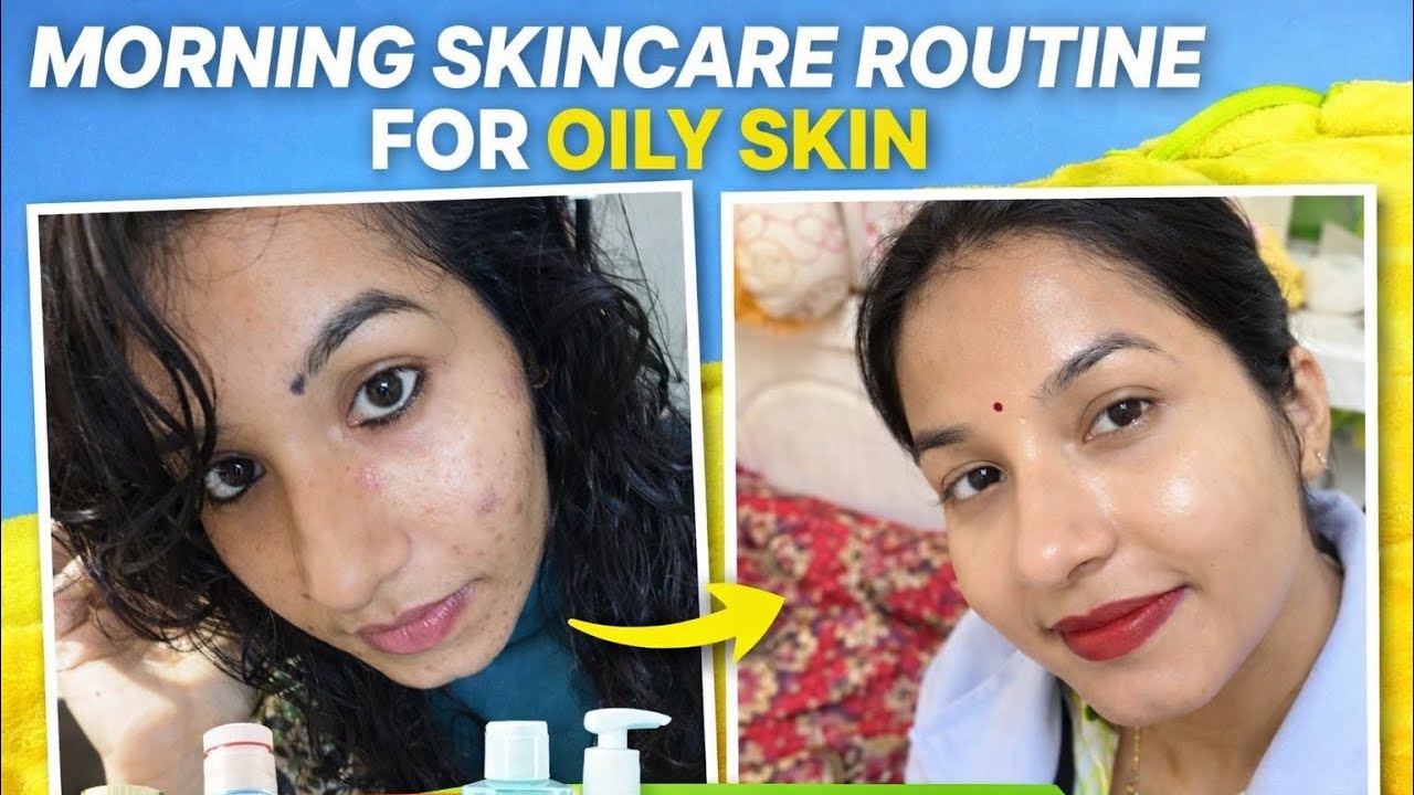 Get glass skin in just 10 days🥰☺️full skin care(oily)