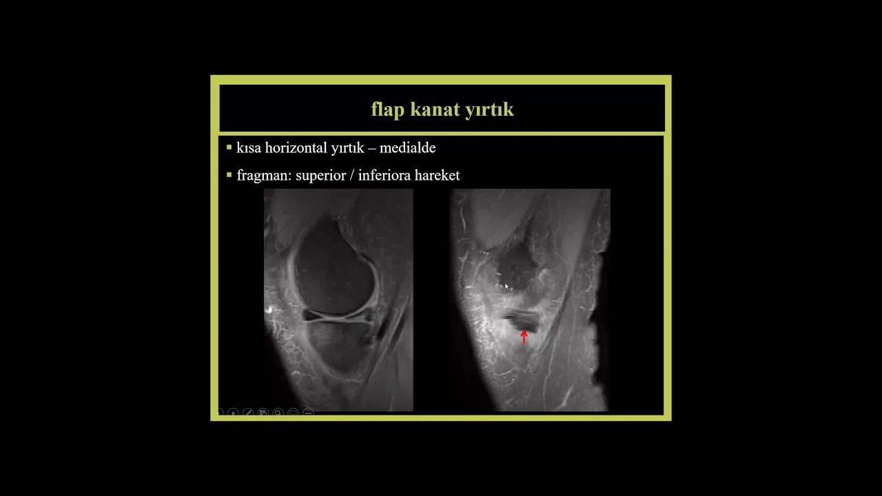 Prof. Dr. Berna Dirim Mete Diz MRG