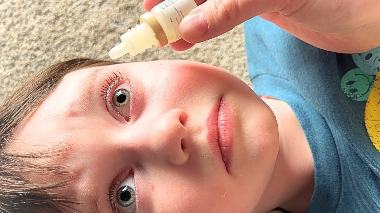 Eyedrops With An Autistic Kid