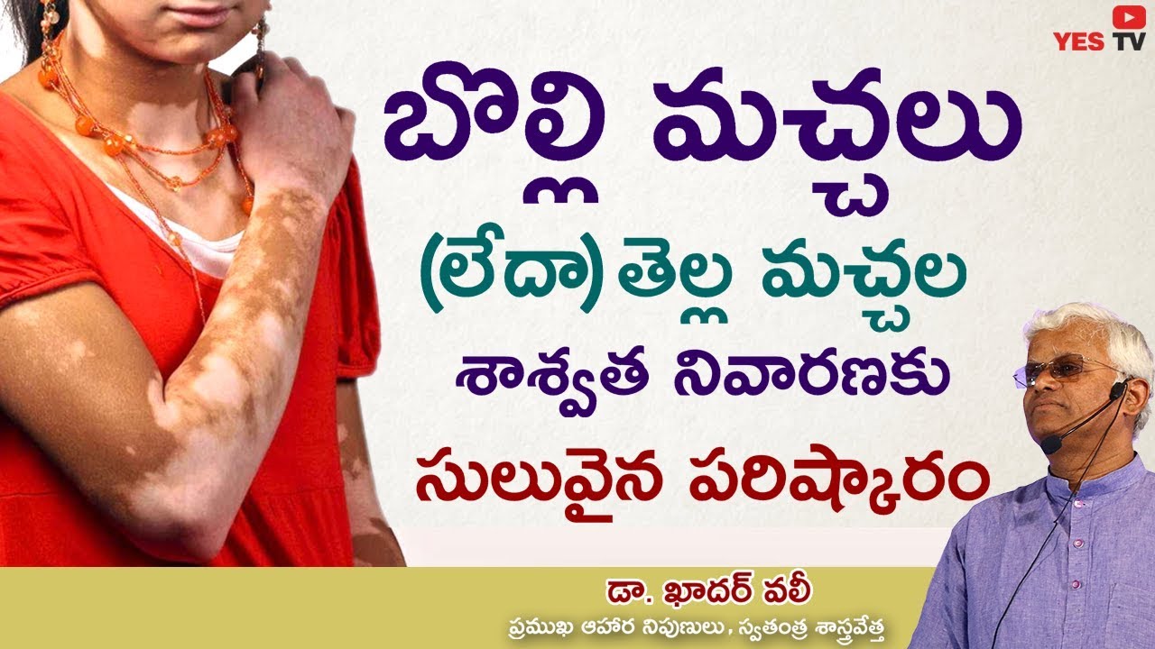 బొల్లి మచ్చలు లేదా తెల్ల మచ్చల శాశ్వత నివారణకు Dr .ఖాదర్ వలీ గారి  సులువైన పరిష్కారం YES TV