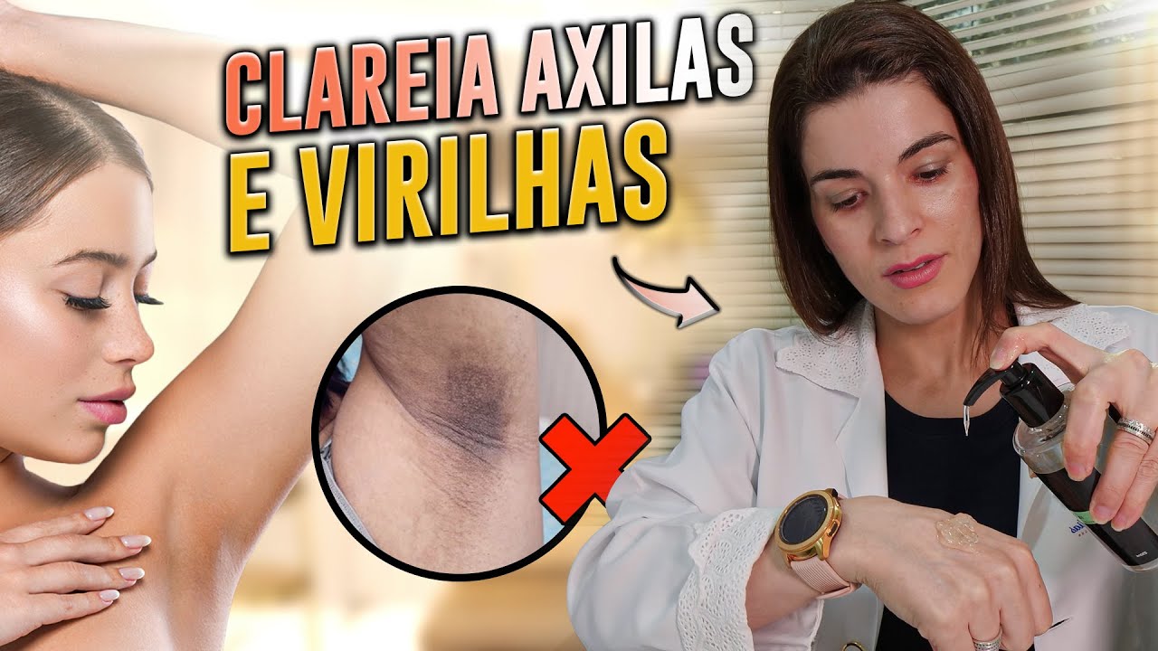 CLAREIA MANCHAS NO CORPO, AXILAS E VIRILHAS !