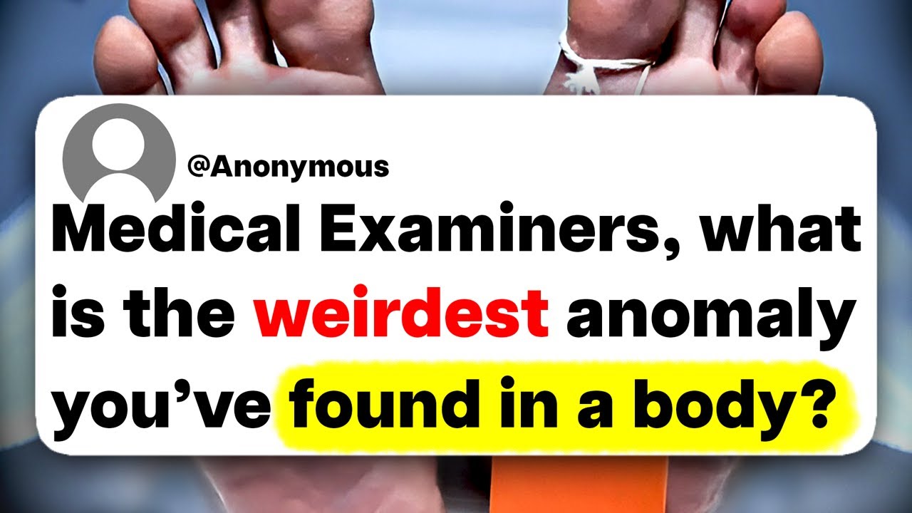 Medical Examiners, what is the weirdest anomaly you've found in a body?