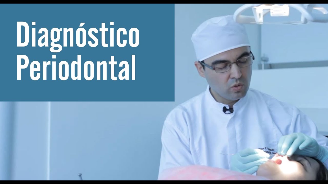 Diagnóstico periodontal | Juan Salgado |  diagnostico periodontal
