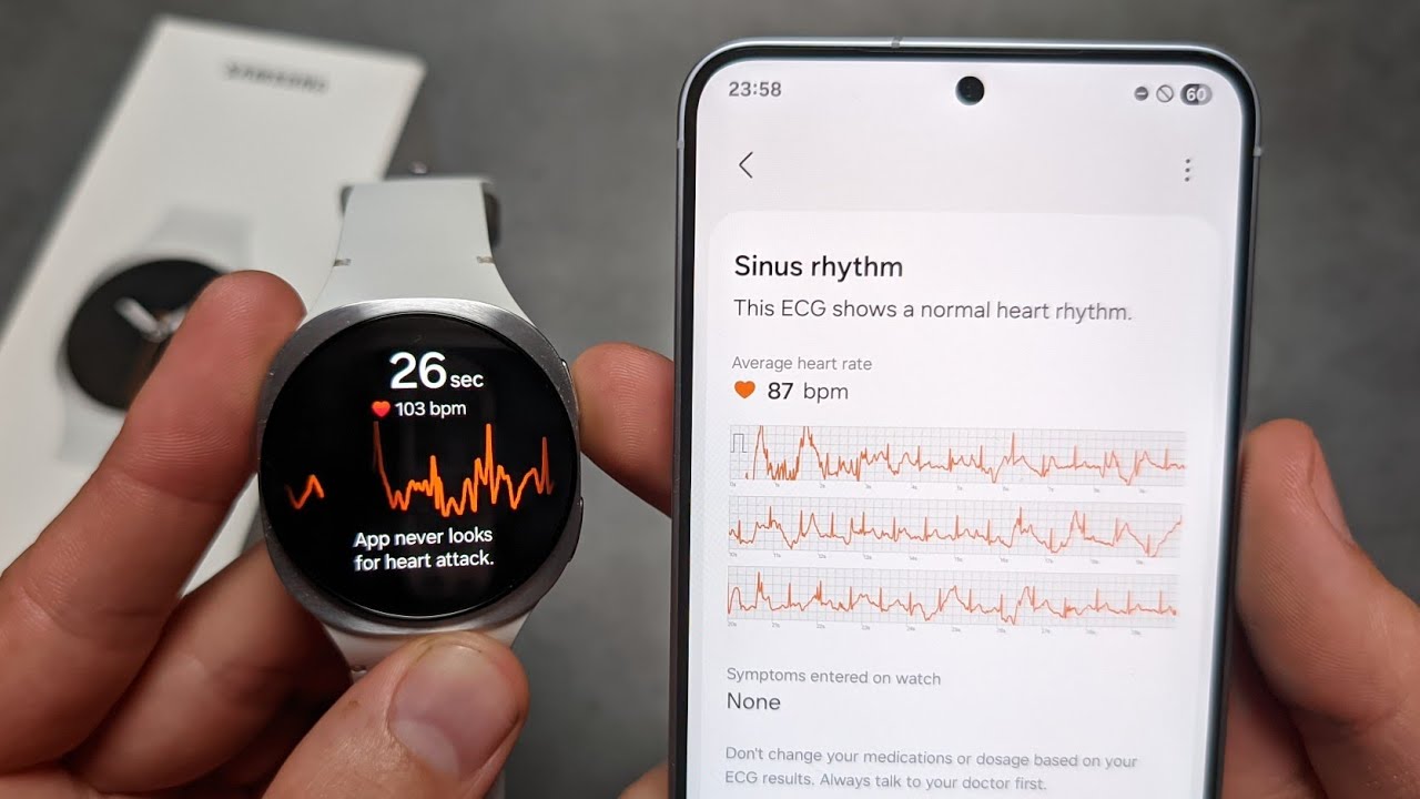 ЭКГ на Samsung Galaxy Watch 8 — как включить и использовать (электрокардиограмма)