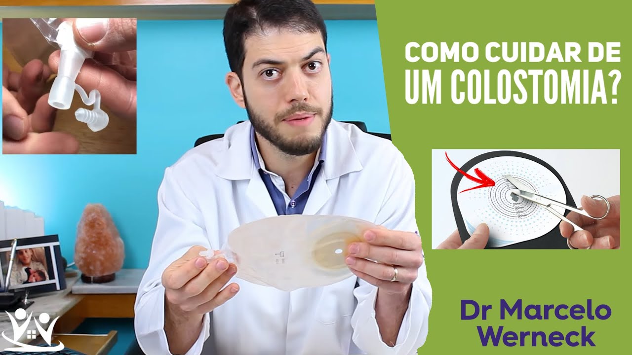 Como cuidar de uma colostomia - COM DEMONSTRAÇÃO!