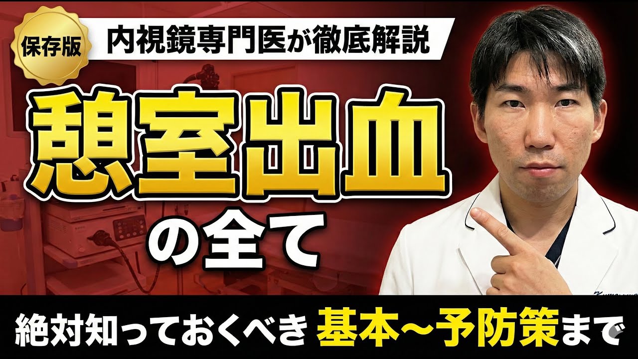 【血便の原因No.1】大腸憩室出血のすべて｜症状・検査・最新治療と再発予防
