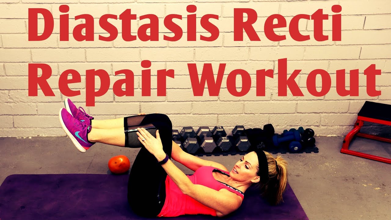 15 Minute Diastasis Recti Repair Workout---Postnatal Core After Pregnancy.