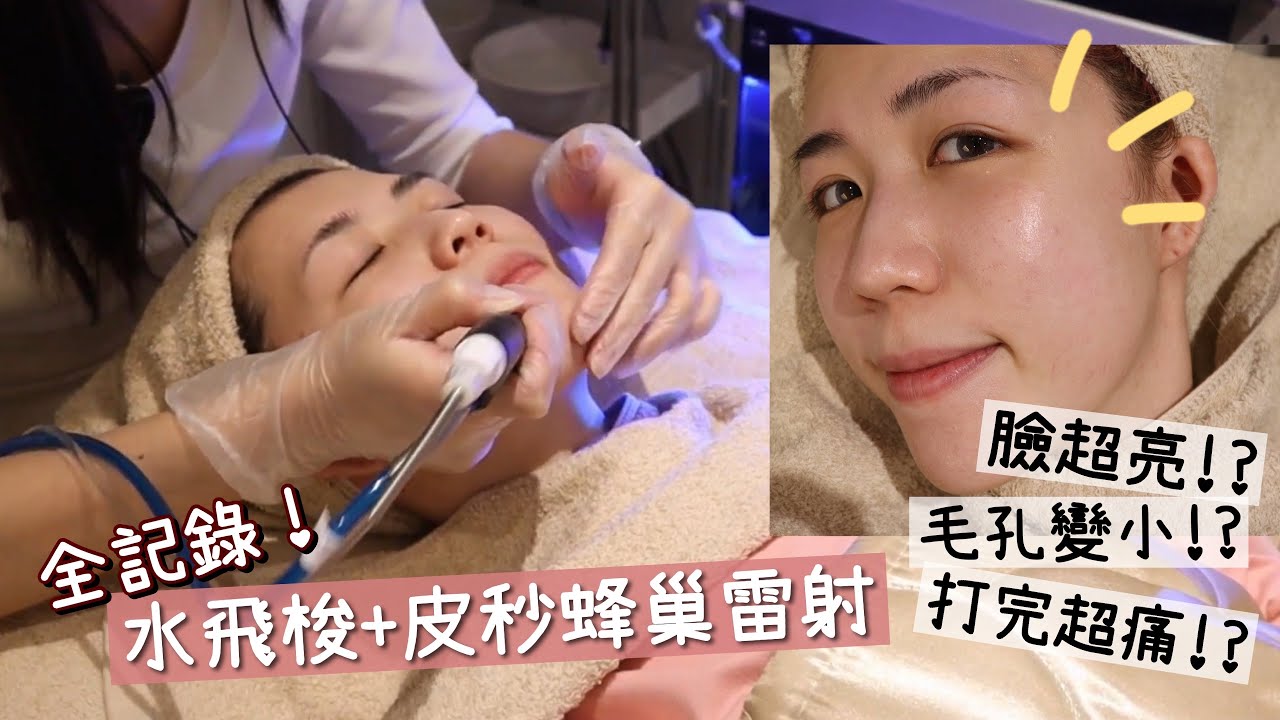 超夯水飛梭&皮秒蜂巢雷射全記錄！皮膚真的會變好？| Yuna悠那