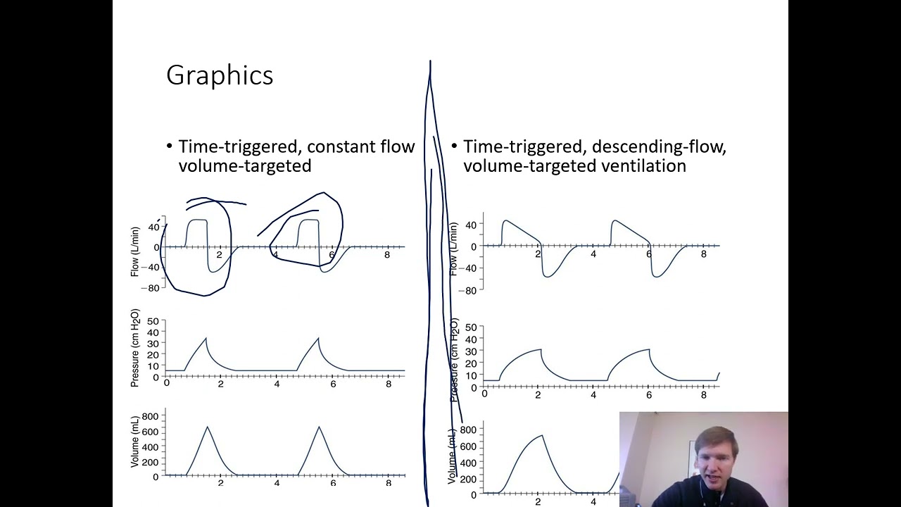 Ventilator Graphics