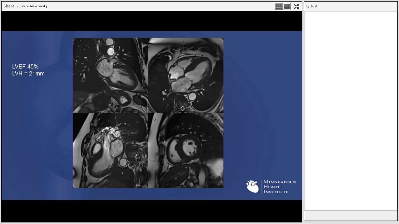 David Lin - Mapping he Future of Cardiac Magnetic Resonance Imaging (CMR) - 10/02/2017