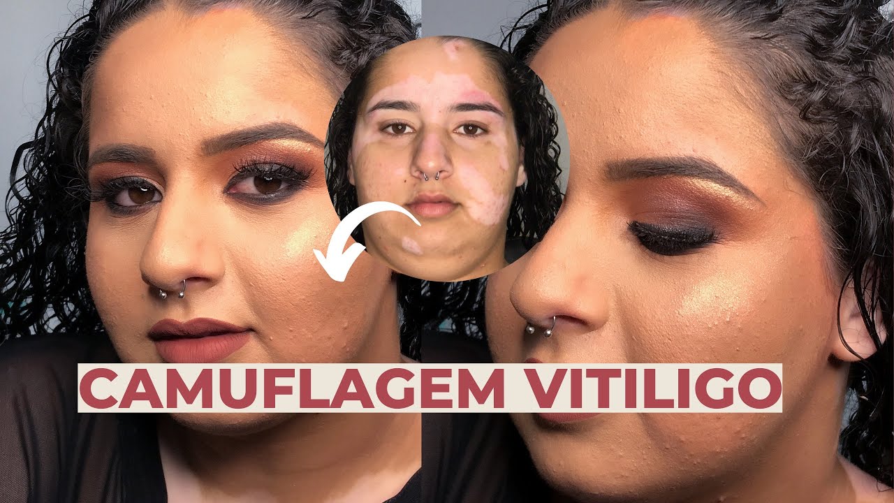 MAQUIANDO CLIENTE CAMUFLAGEM DE VITILIGO por Luana Ramos