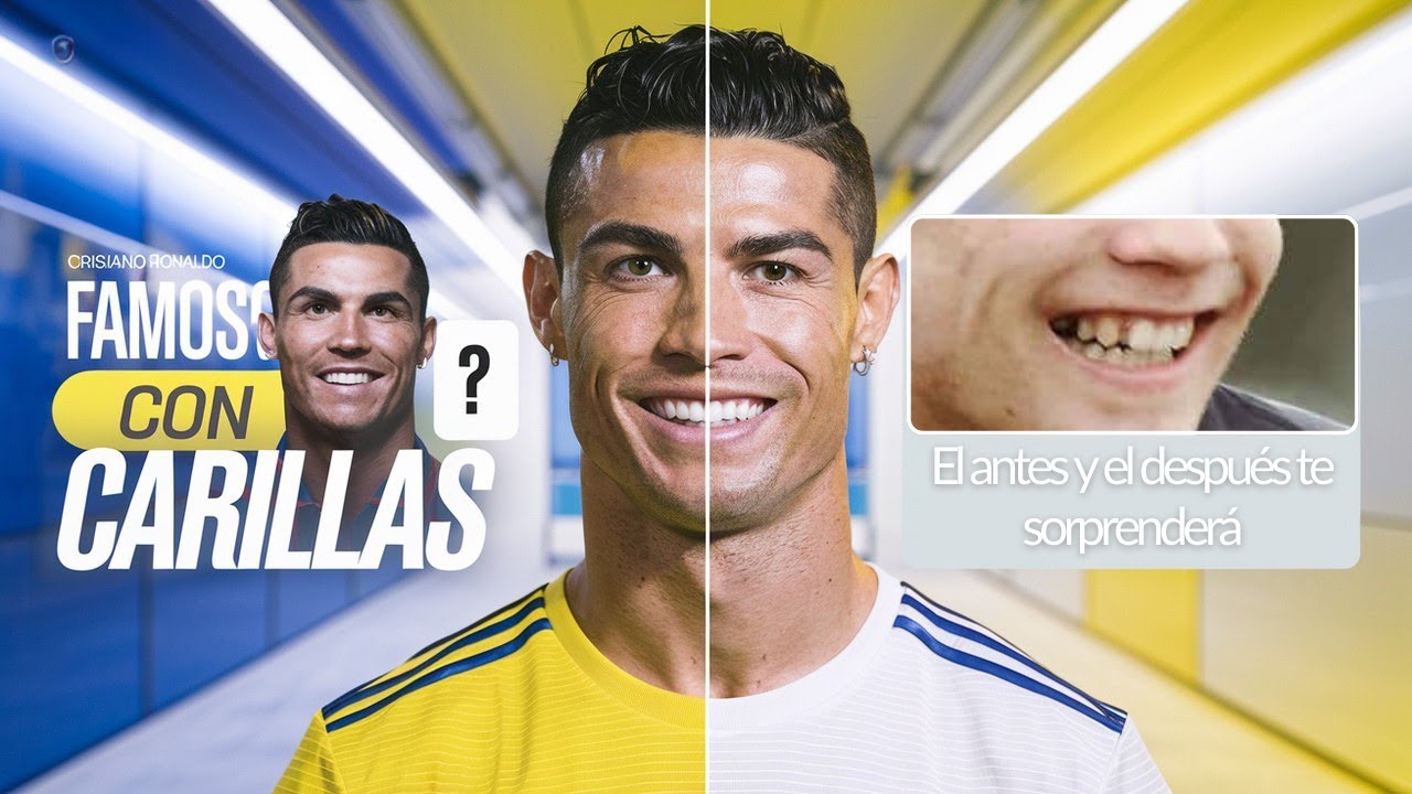 Los 7 Famosos que usan carillas DENTALES y que no lo sabías