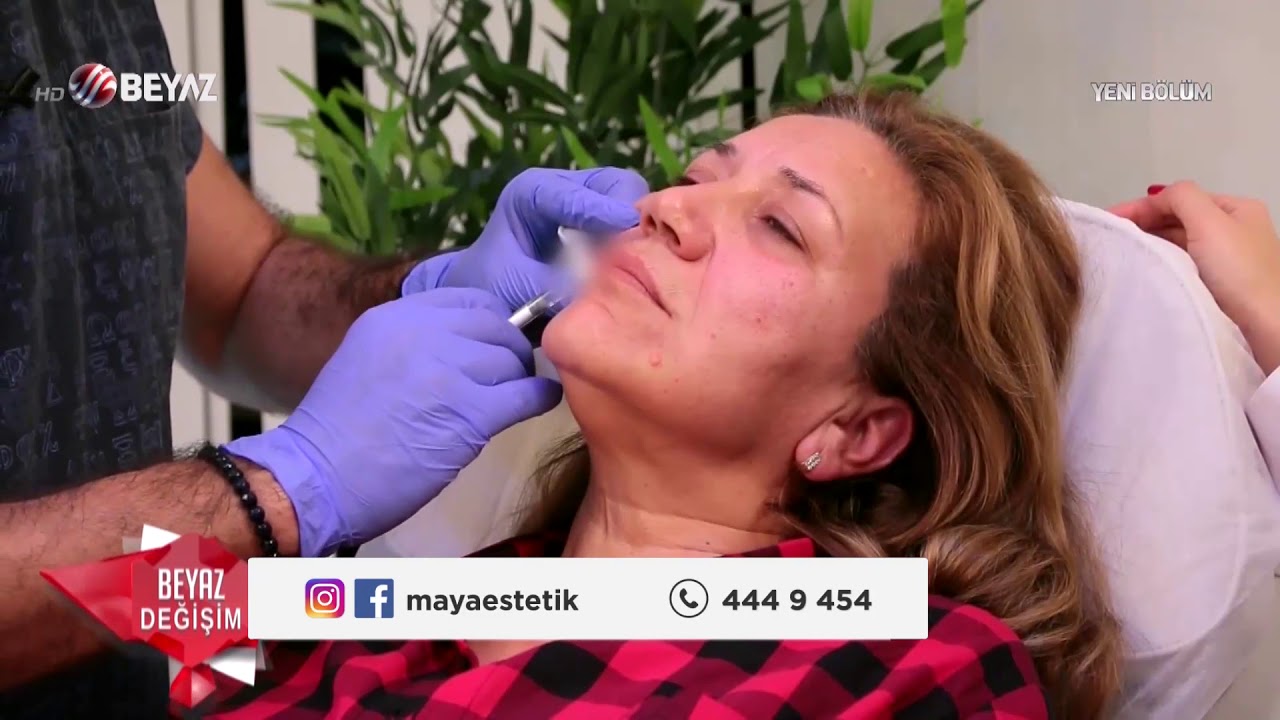Beyaz Değişim 31/12/2017 Nilgün Hanım'ın Değişimi