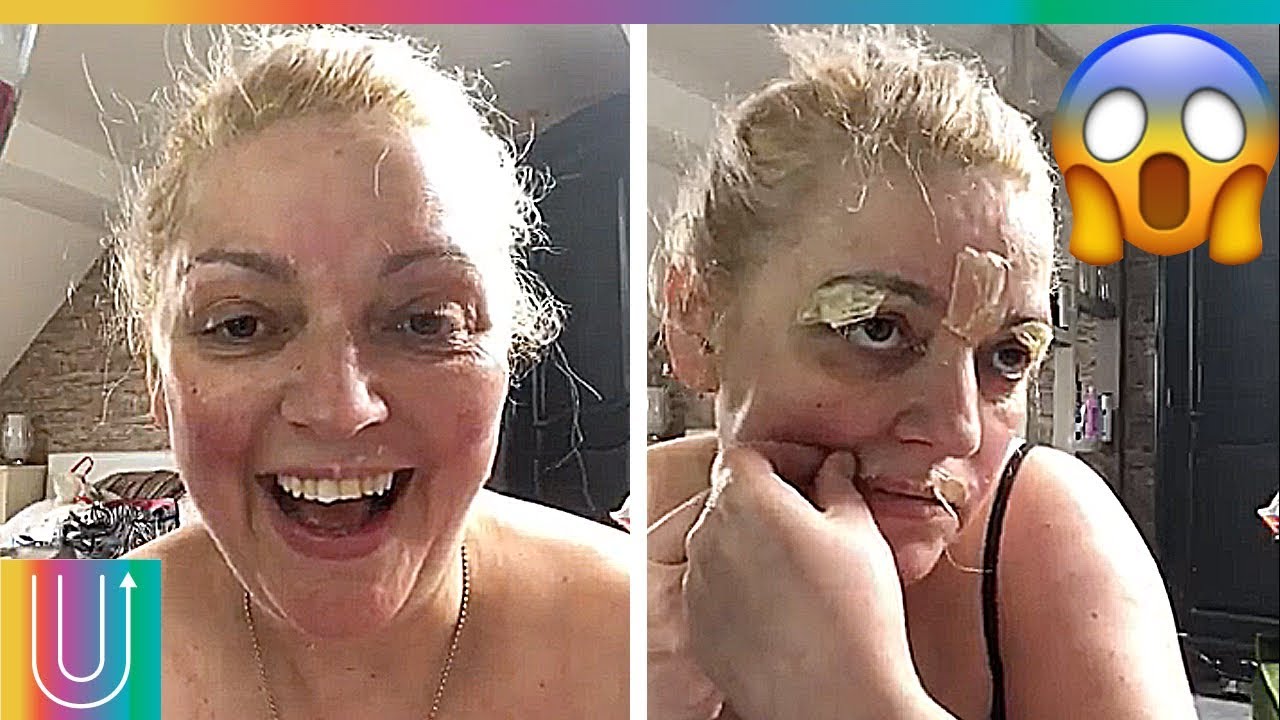 Mujer se depila el rostro con cera caliente