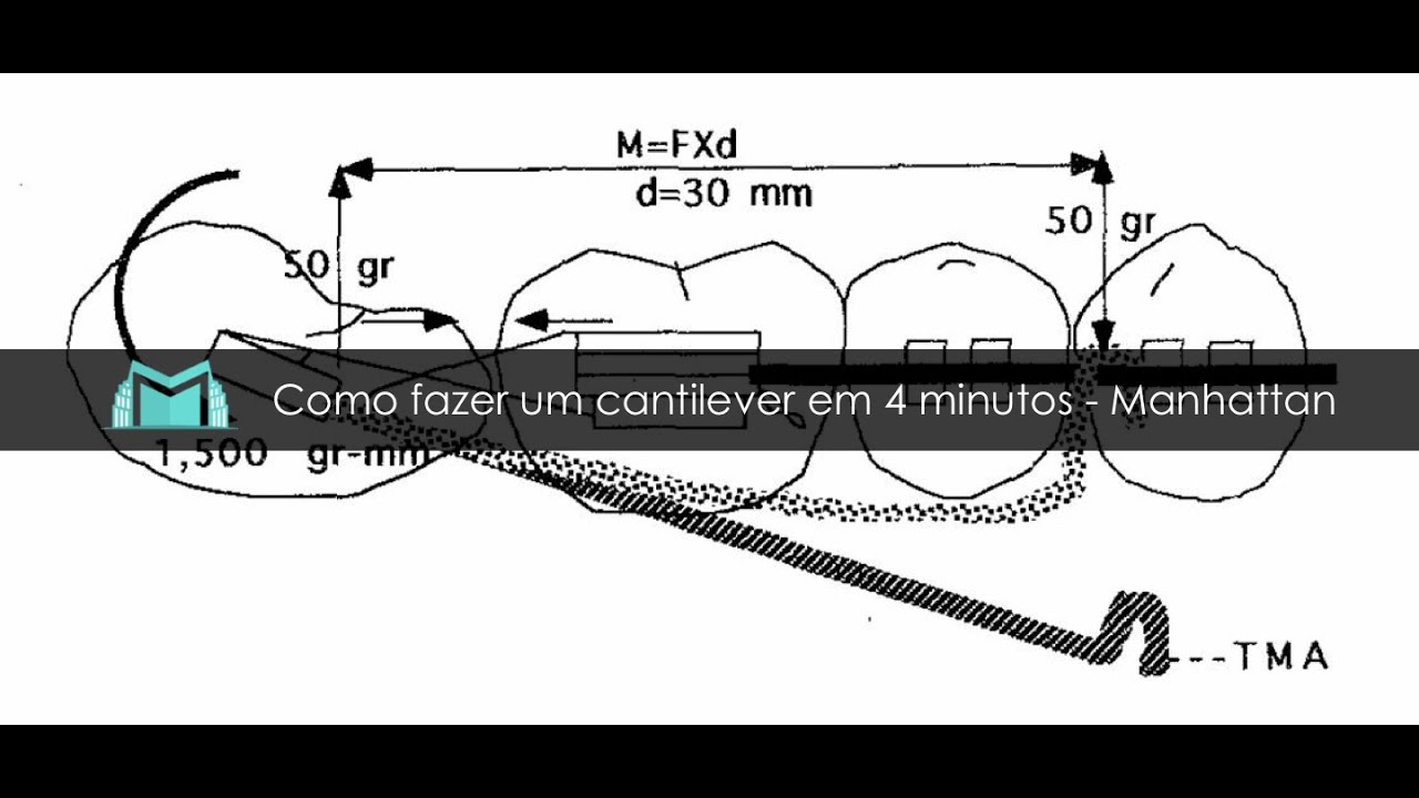 Como fazer um Cantilever em 4 minutos