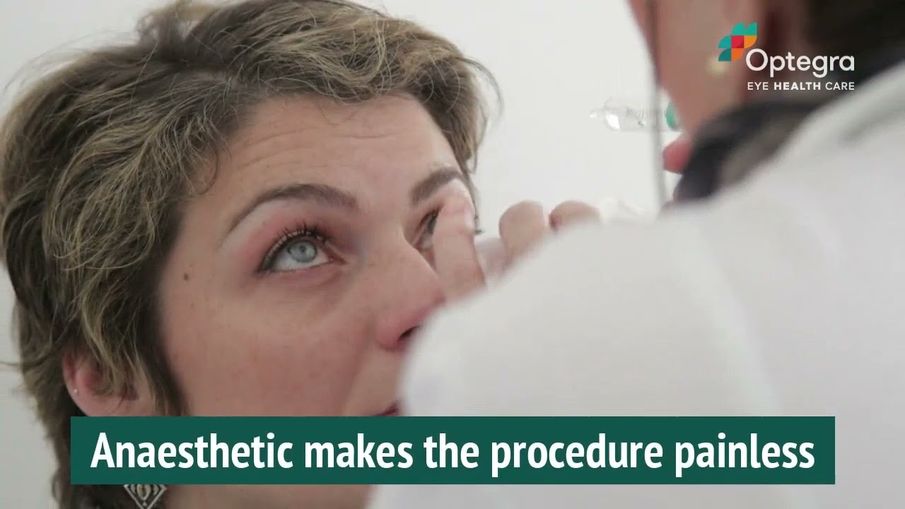 Cataract FAQs Part 2