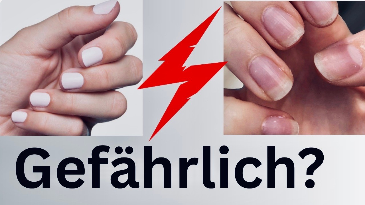 SCHÖN - oder zerstören künstliche Nägel heimlich deine echten Nägel?