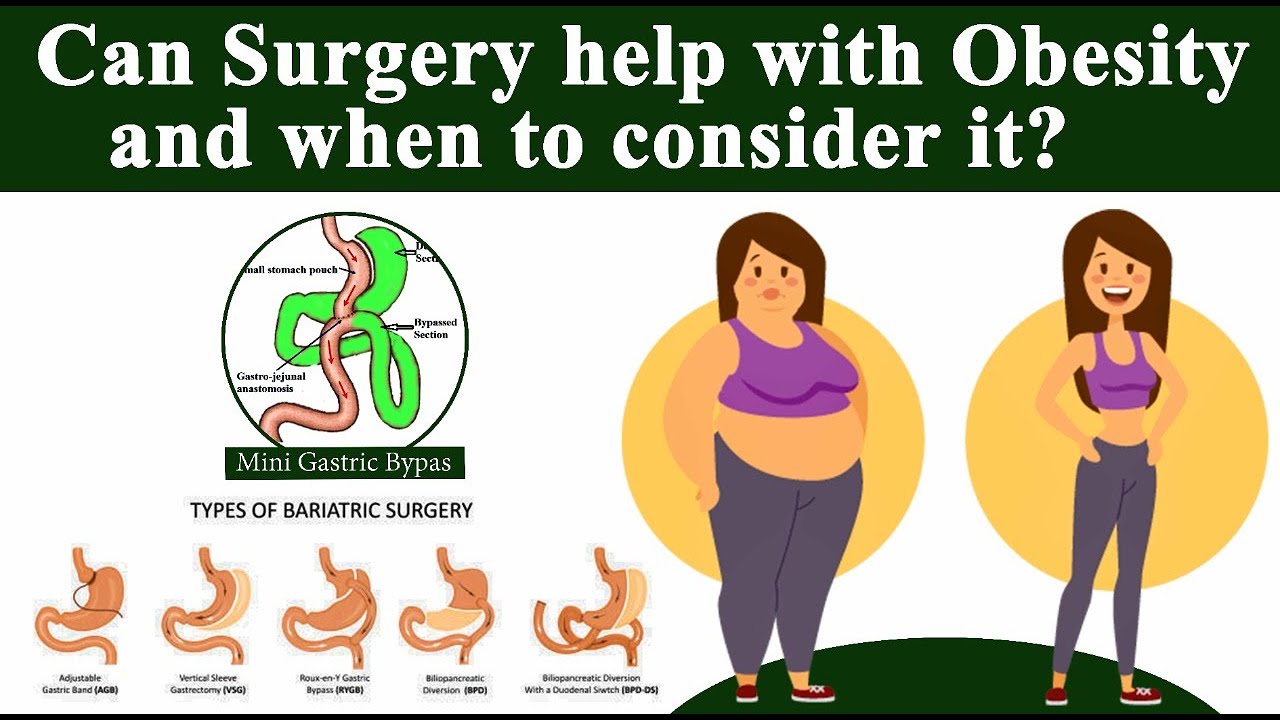 What is Bariatric Surgery| Weight Loss Surgery|Best Bariatric Surgeon|Punjab|India|Dr. Kular
