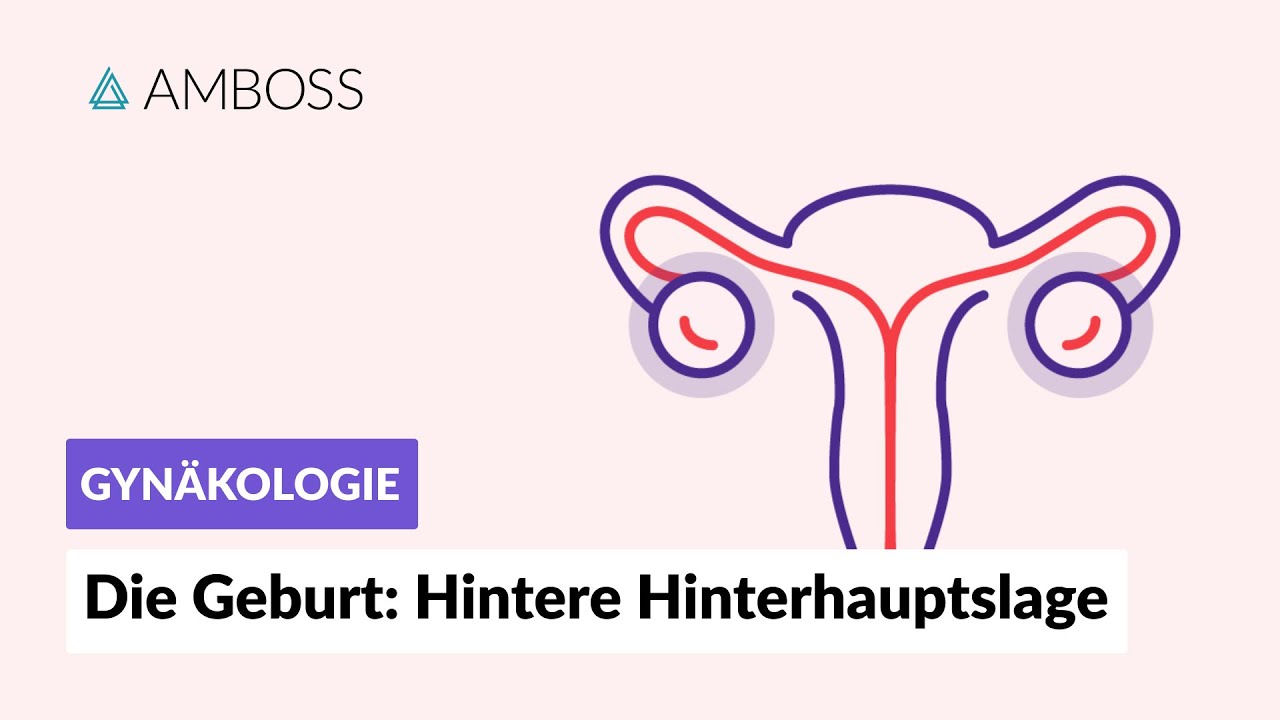 Hintere Hinterhauptslage -- Gynäkologie: Die Geburt -- AMBOSS Video