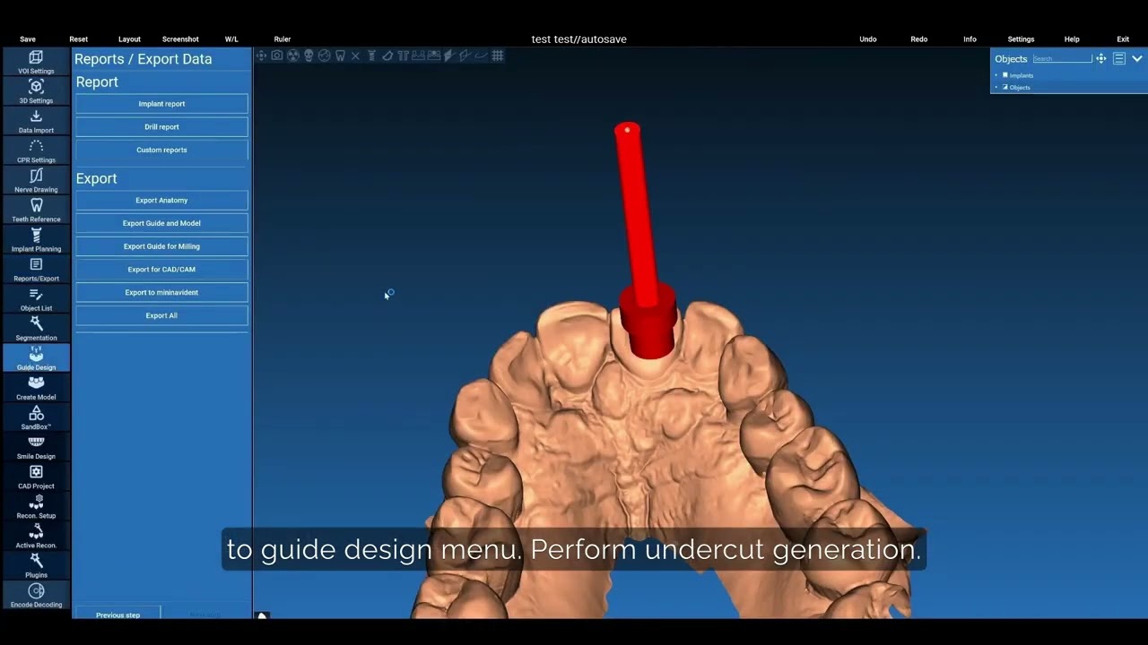 TRX RealGUIDE Workflow | matrix® Digital Academy