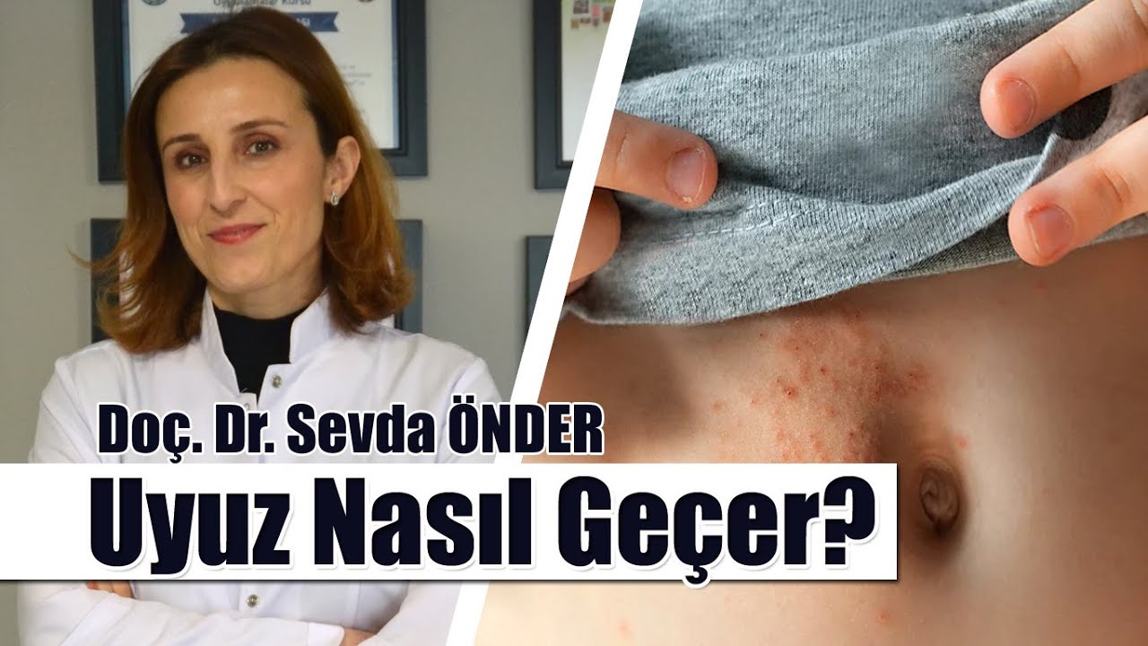 Uyuz Hastalığı Etkili ve Kesin Tedavisi Nedir? | Uyuz Nasıl Geçer Kesin Sonuç!