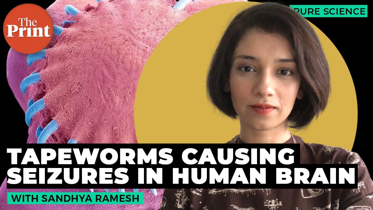 What is neurocysticercosis &mdash; seizures caused by tapeworm cysts in human brain