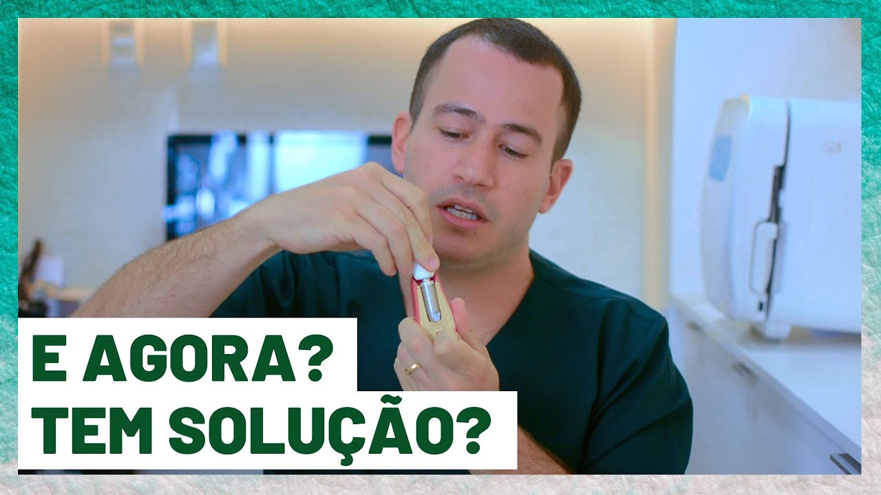 QUEBROU O PARAFUSO DO IMPLANTE, E AGORA ? -DR. GUILHERME FELIX