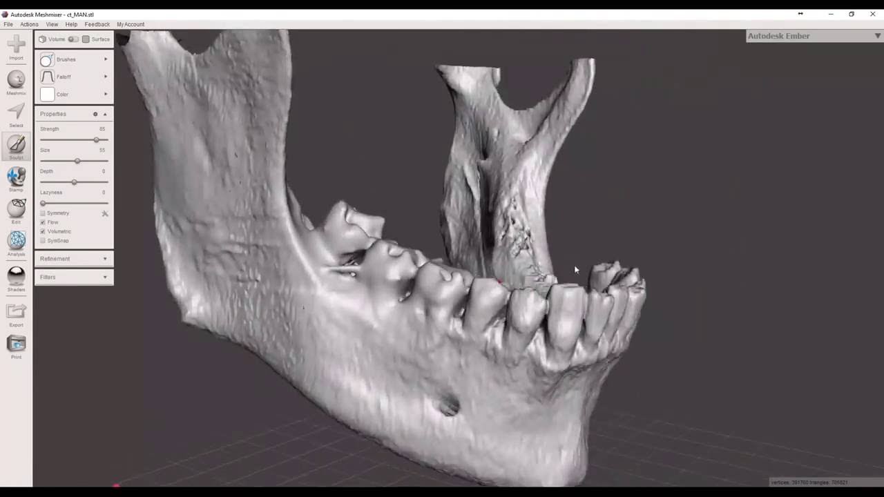 Convert Dicom CT to STL file  3D printable