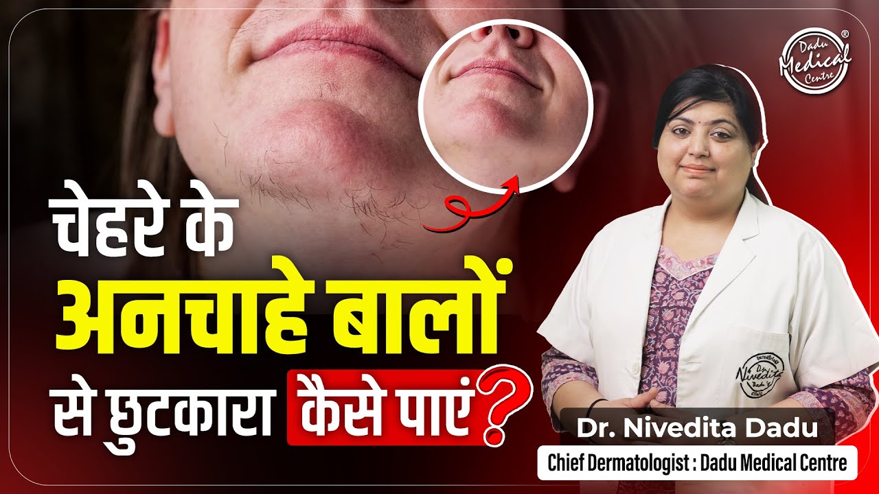 चेहरे के बालों का समाधान | Chehre ke baal kaise hataye | Facial Hair Treatment | Dr. Nivedita Dadu