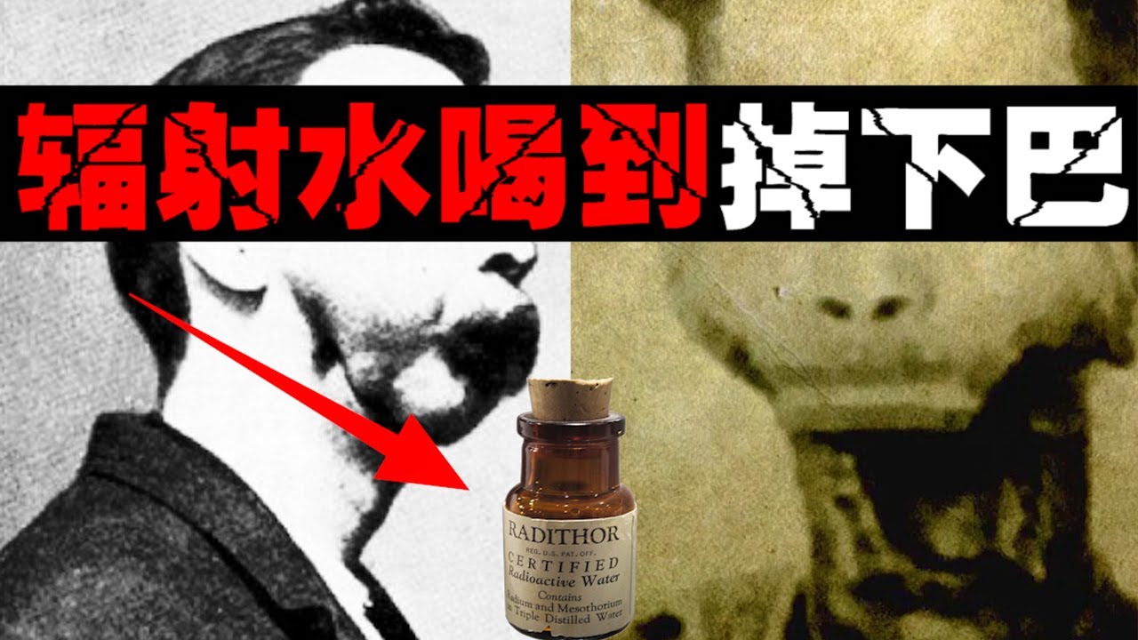 【庸医与万能药】把辐射水当保健品后，喝完掉下巴【郑郑得证】