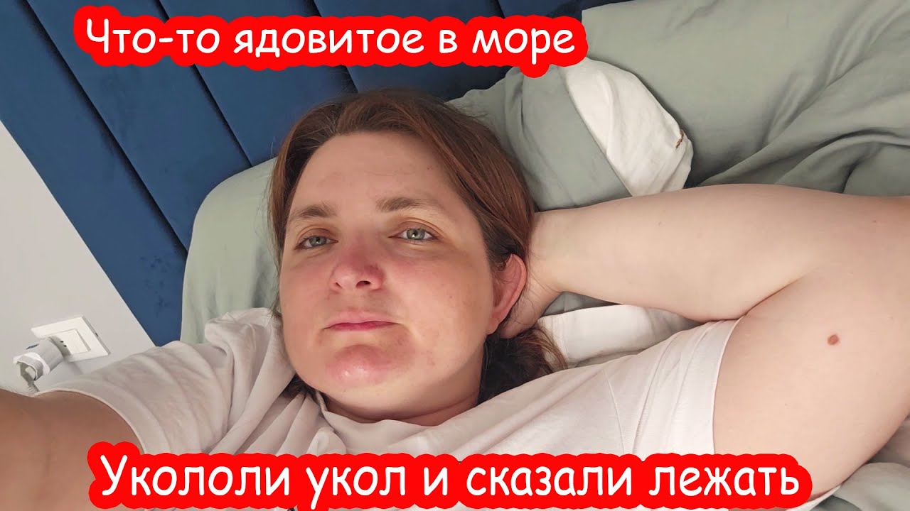 VLOG Меня укусило что то ядовитое в море. Поехали в скорую
