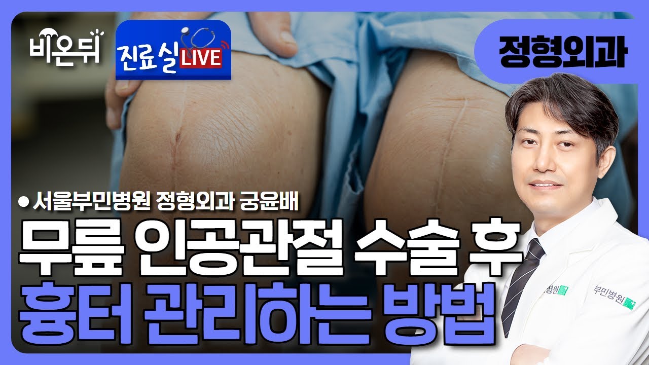 [진료실통라이브] 무릎 인공관절 수술 후 흉터 관리 (흉터 마사지) / 부민병원 정형외과 궁윤배