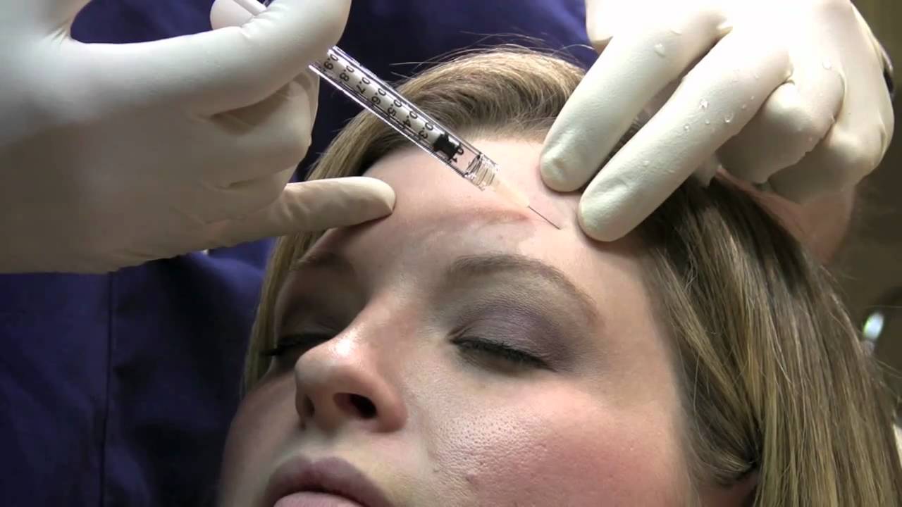 Botox injection to decrease wrinkles above eyebrows in washington DC, Virginia 20170, Maryland 20815
