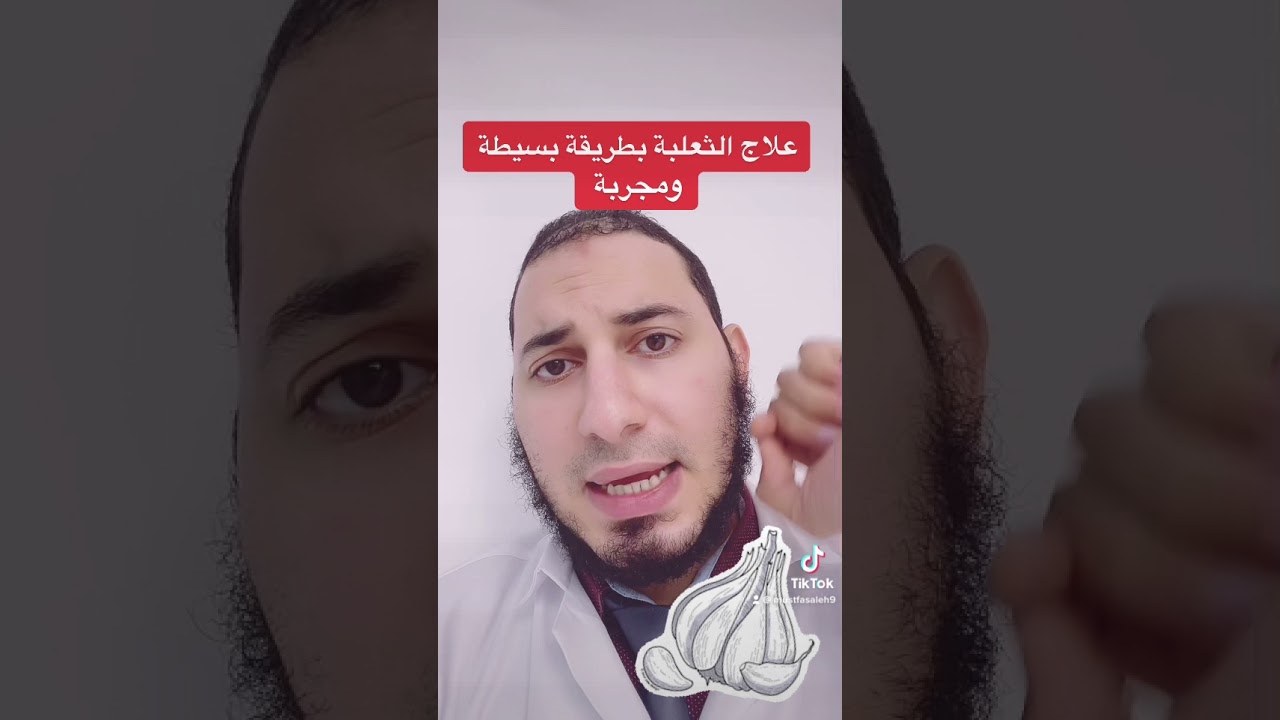 علاج الثعلبة في الرأس والذقن