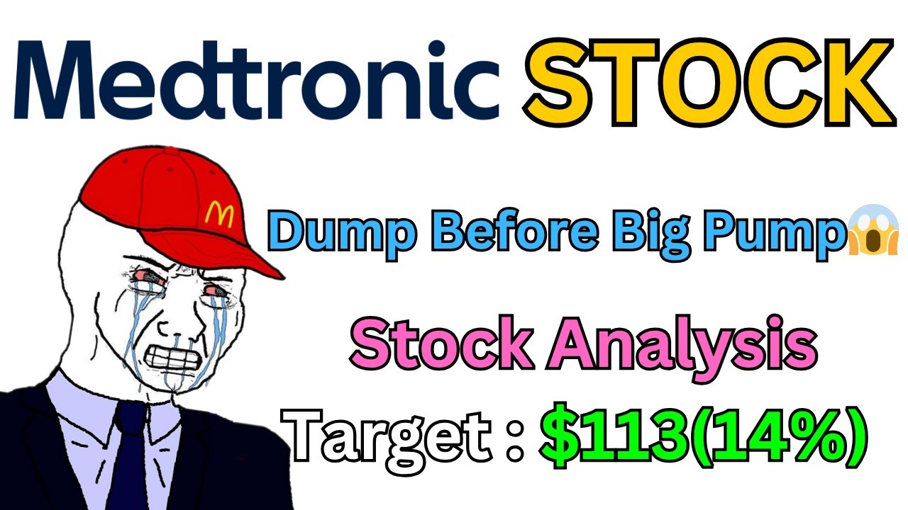 Большой прорыв в акциях Medtronic Plc | Инвесторы покупают? Анализ акций MDT