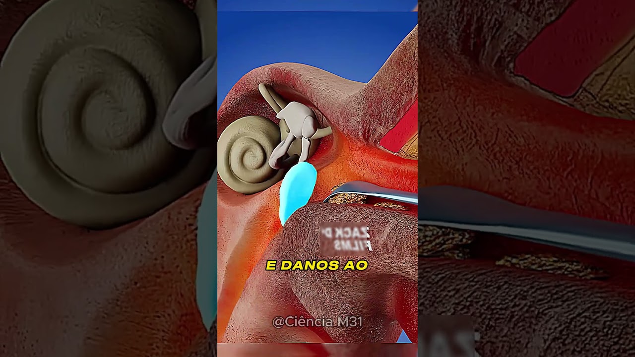 COMO LIMPAR O OUVIDO CORRETAMENTE?🤔 