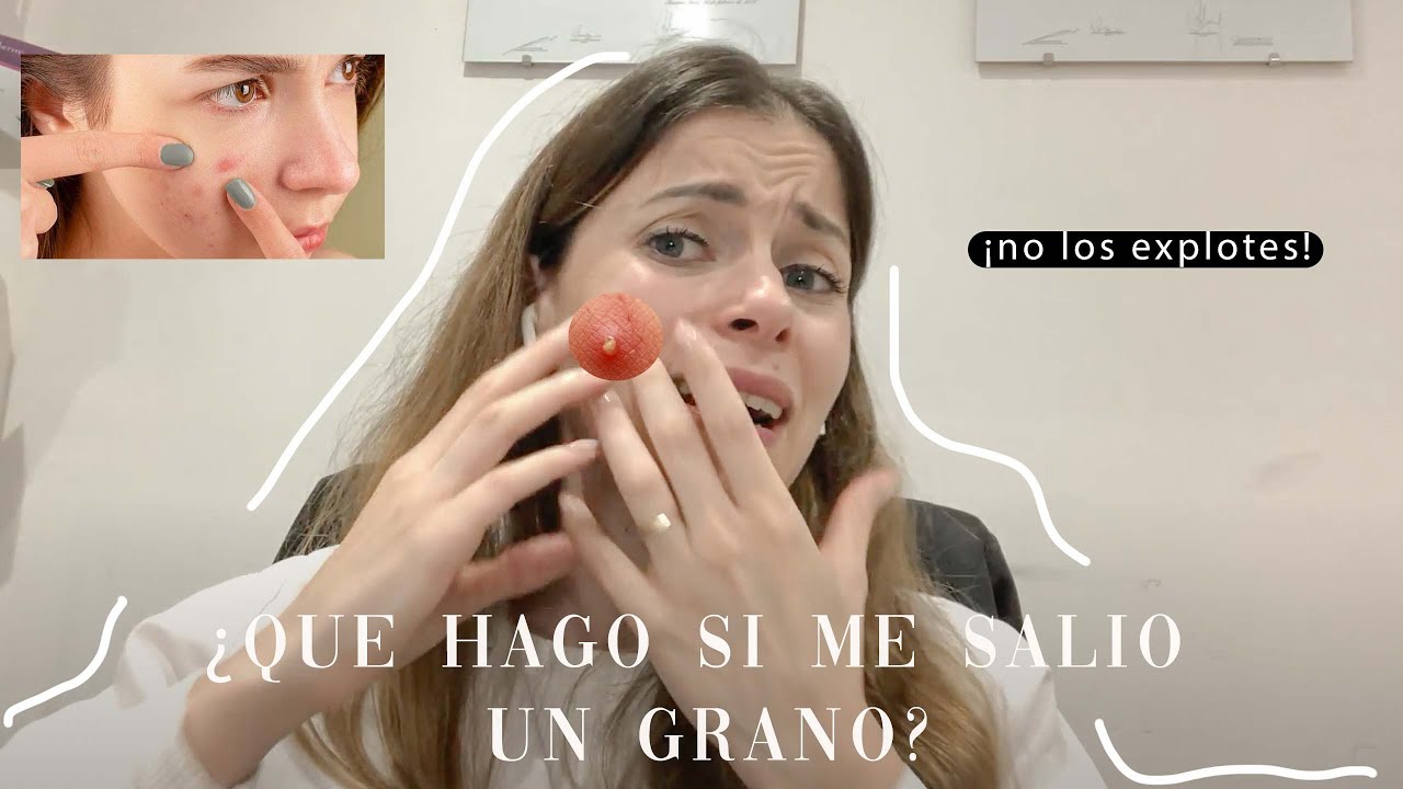 ME SALIÓ UN GRANO, QUÉ DEBO HACER? | Dermatóloga responde