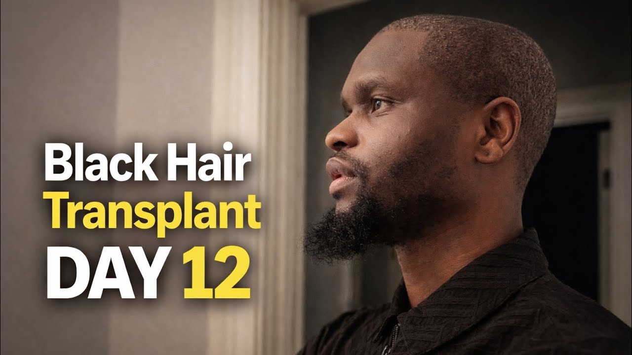 Hair Transplant Scab Removal | What It Really Looks Like